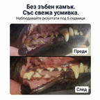 Dental Powder - Чисти зъби • Свеж дъх • Здрави венци